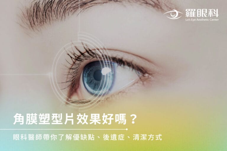 角膜塑型片效果好嗎？眼科醫師帶你了解優缺點、後遺症、清潔方式